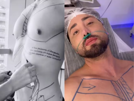 “Eu sou do centro cirúrgico”: Rico Melquiades detalha novos procedimentos de R$ 150 mil