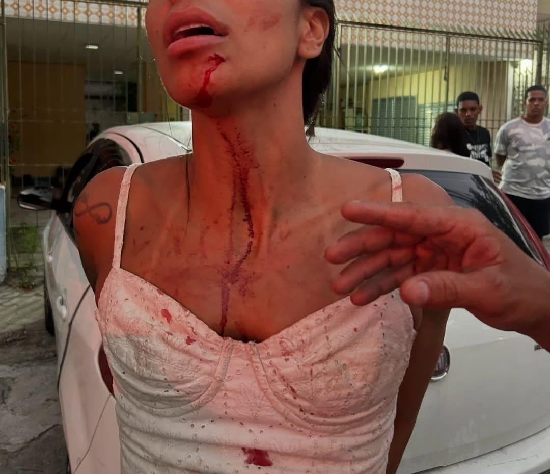 Atacante do Vila Nova é acusado de agredir mulher em bar no Rio de Janeiro