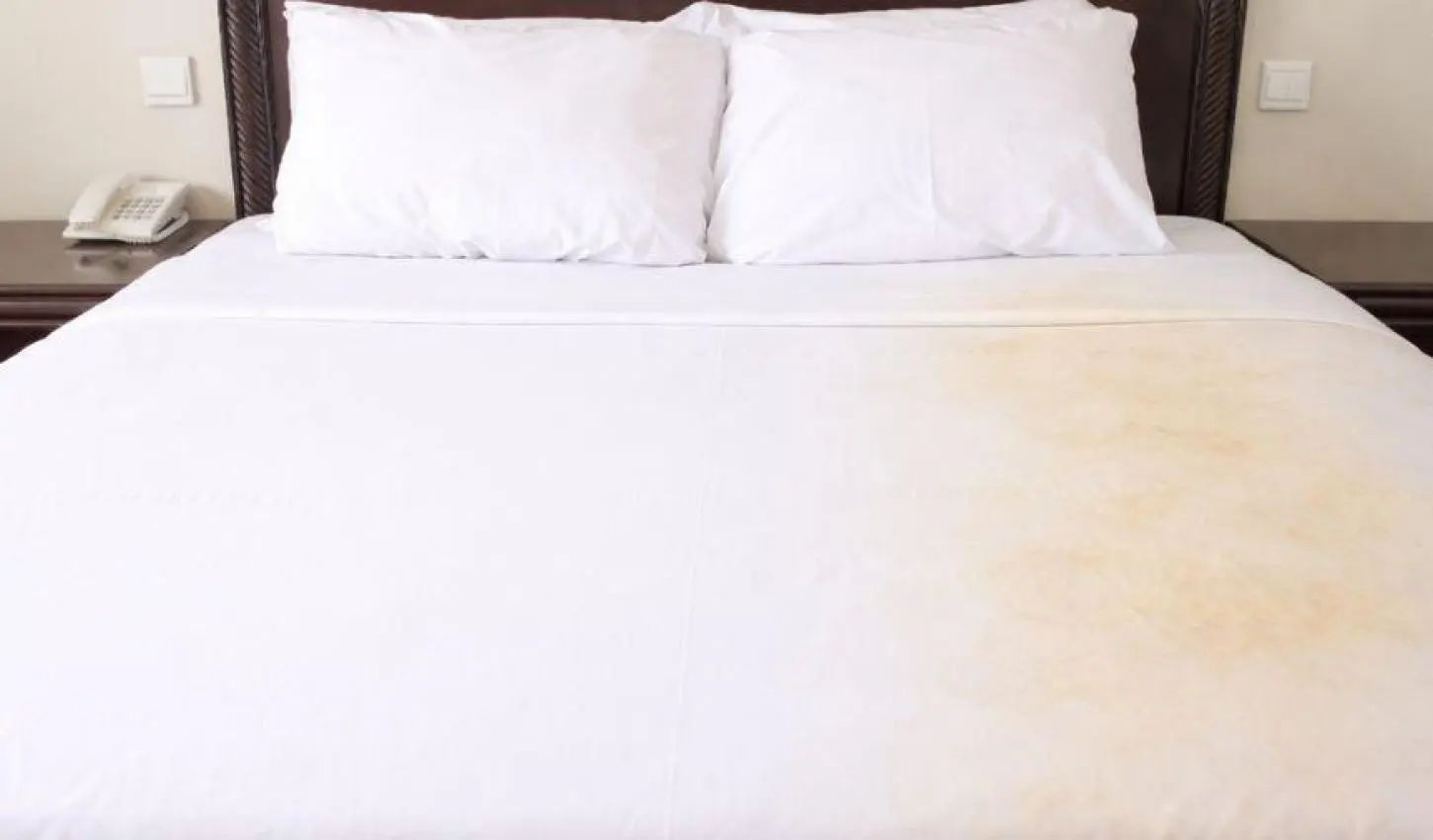 Por que o lençol do lado do homem fica amarelo? Entenda