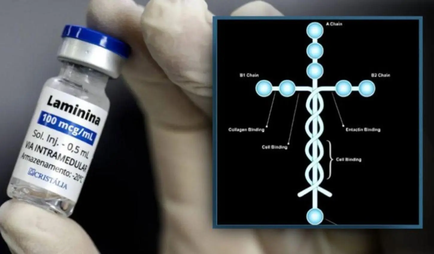 Polilaminina: entenda por que o Brasil perdeu a patente