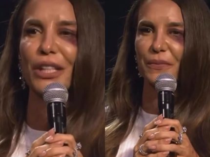 Ivete Sangalo confirma que passará por cirurgia neste domingo