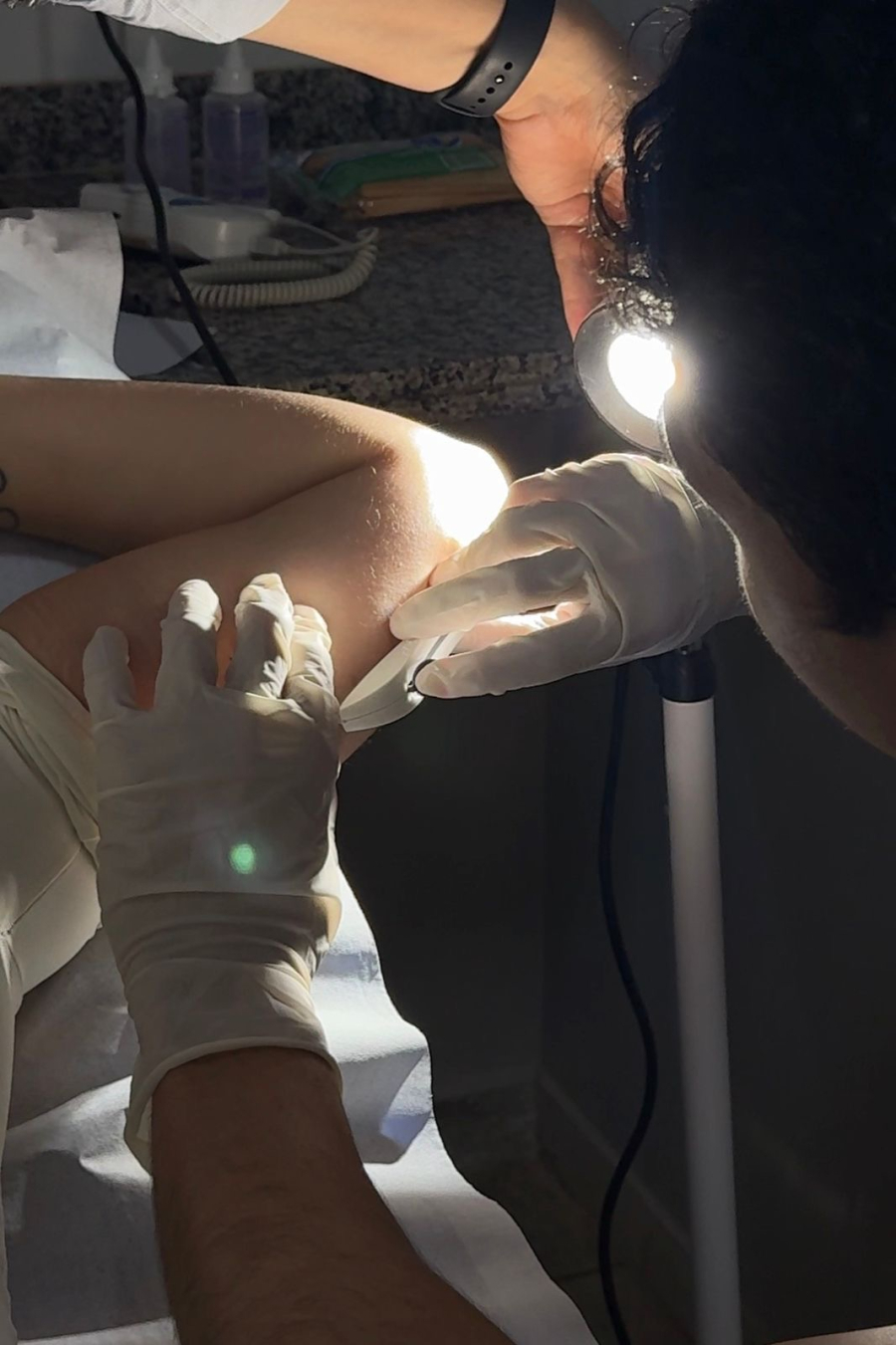 Prefeitura de Aparecida inicia oferta do implante contraceptivo implanon