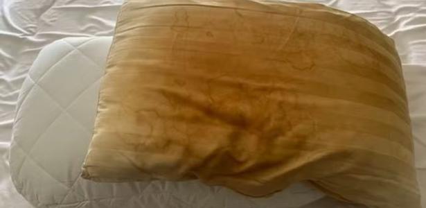 O que deixa o travesseiro amarelado mesmo com fronha sempre limpa e trocada